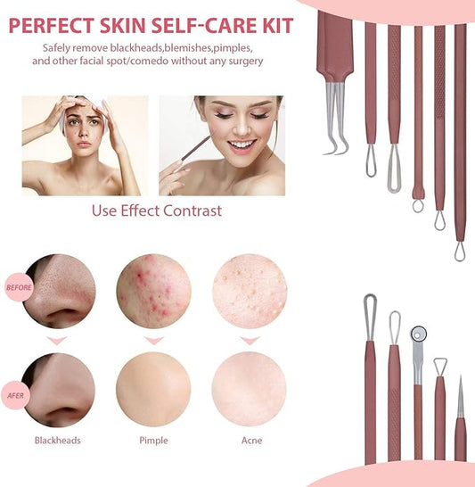 JPNK Blackhead Remover Tool Comedones Extractor Acne Removal Kit for Blemish, Whitehead Popping, 6 Pcs Zit Removing for Nose Face Tools with a Leather Bag (Pink)