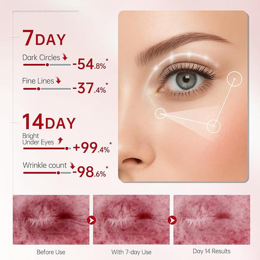 Peunitory Eye Balm Stick,Under Eye Cream Anti-Wrinkle Firming Treatment | Dark Circle Brightener | Hydrating (0.32oz)