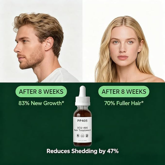 PP405 Hair Growth Oil - Anti Hair Loss Treatment & Serum, Fast Absorbing, Non Greasy Formula for All Hair Types Men/Women scalp serum 60ml | 2 fl.oz (Large-1pcs)