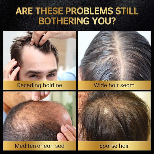 Minoxidil for Men & Women, With Biotin, Batana Oil, Rosemary Essential Oil, Effective Hair Loss Solution, Hair Loss Treatment for Hair Regrowth, Non-Greasy 5% Minoxidil - 60ml