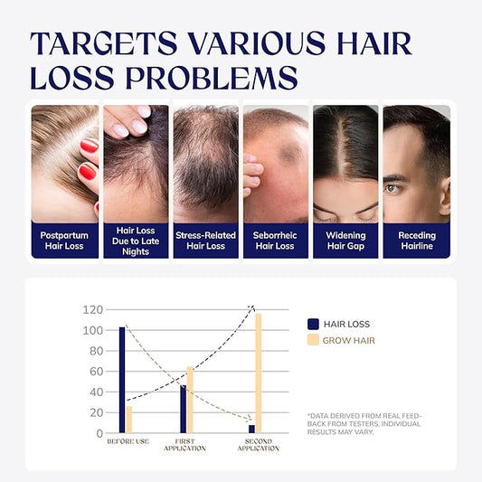 Hair Growth Spray, Rice Water & Biotin & Caffeine, Hair Growth Serum for Men & Women, Hair Oils for Hair Growth -Longer, Fuller Hair, Enriched with Seven Herbal Extracts 2.03 Fl Oz (Pack of 1)