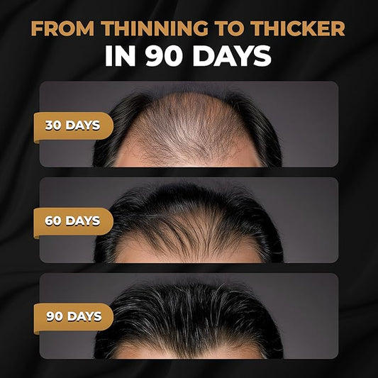 SPARTAN™ Root Activator Conditioner For Men - Hair Growth Conditioner, Thickening Hair Moisturizer for Hair Loss and Thinning Hair
