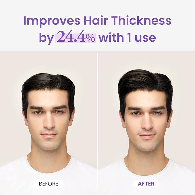 Dr.groot Rosemary Mint Oil Tonic for Hair Growth with Biotin, Hyaluronic Acid, Thickening & Scalp Nourishing. Korean Haircare. Sulfate-Free, Silicon-Free, Paraben-Free (3.38 fl oz/ 100ml)