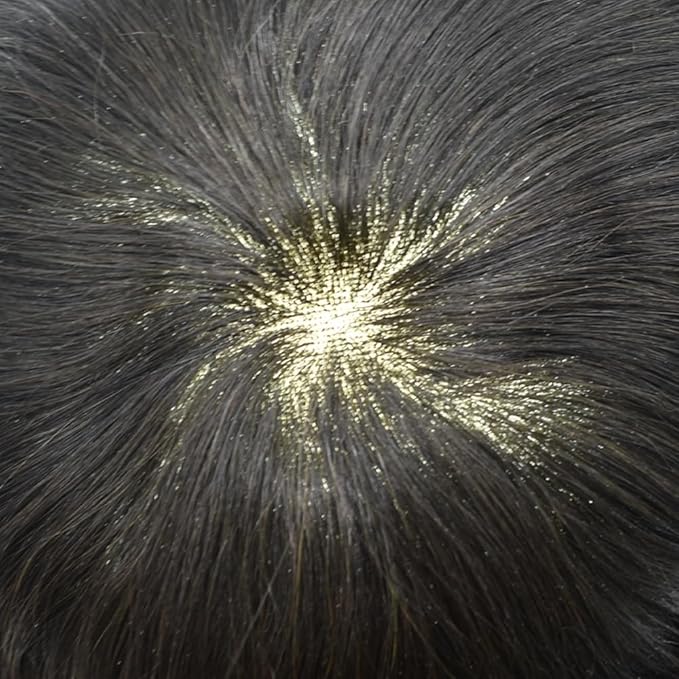 FACE MIRACLE Toupee for Men French Lace Hairpiece Human Hair Replacement System Skin PU Mens Toupee Hair Wigs for Man V-Looped Front Hair Prosthesis 5"X7" 2# DARKEST BROWN