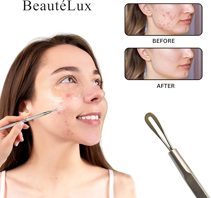 Blackhead Removal Tool, 2-in-1 Acne Extractor Tool - Stainless Steel Blackhead/Whitehead Remover for Face/Nose, Grey Leather Pouch
